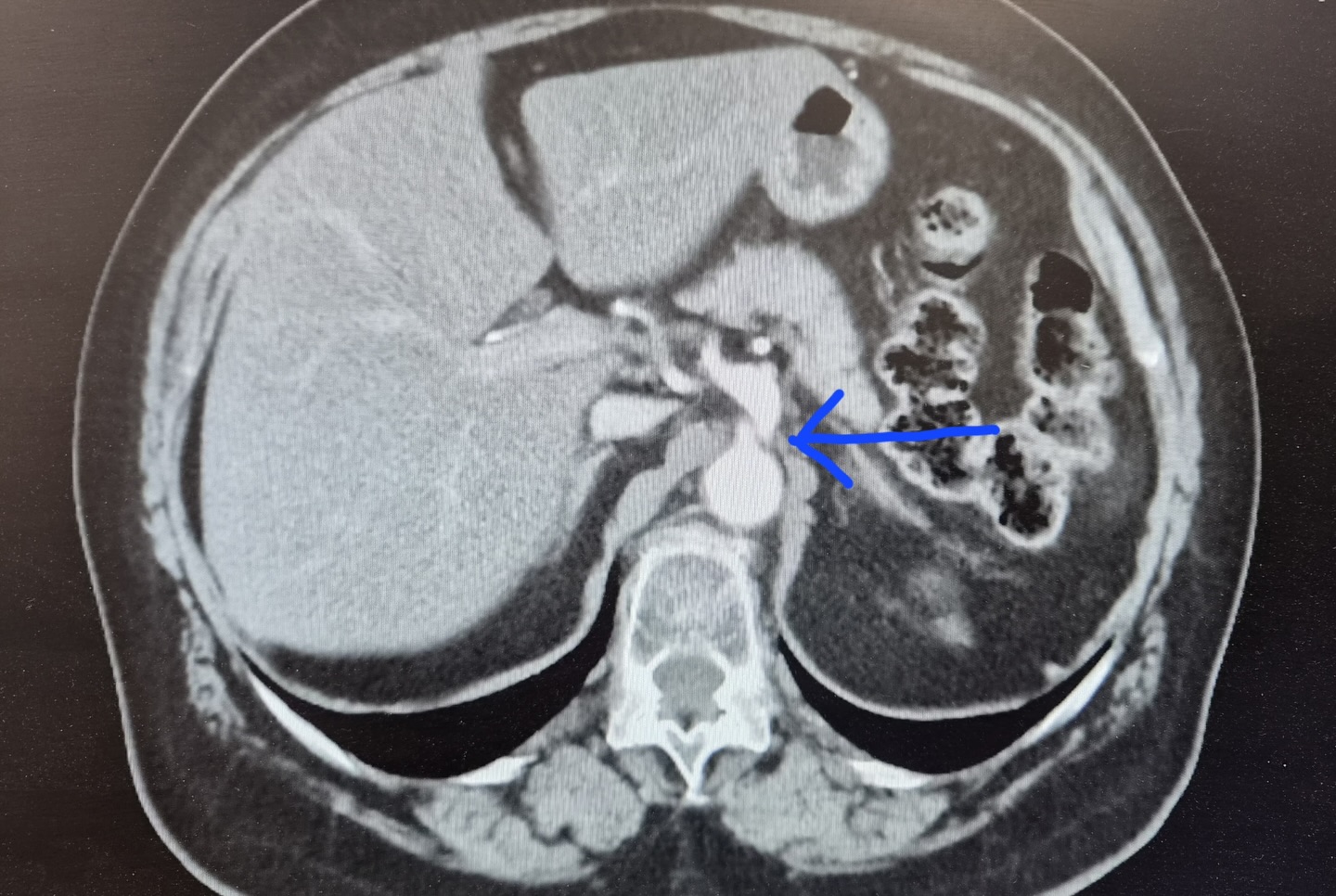 656004129 17915825499340711 1801525008378609905 n